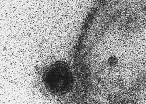 Coronavírus infecta e se replica em glândulas salivares, aponta estudo da USP