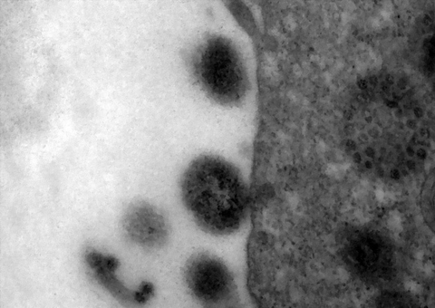 Amazonas apresenta estabilidade nos casos de síndrome respiratória, diz Fiocruz