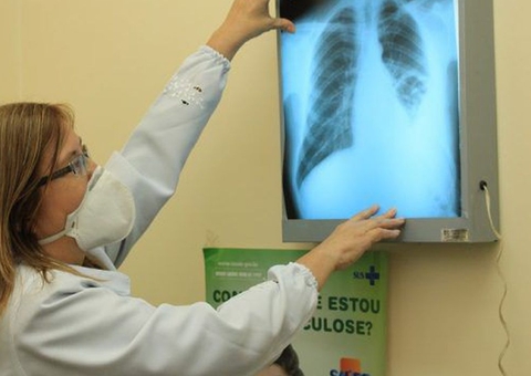 Amazonas, RJ e Acre lideram ranking de mortes por tuberculose no país