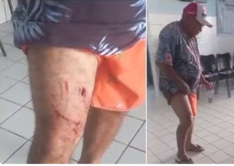 Idoso escapa de ter perna devorada por jacaré em lagoa