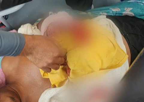 Pescador tem braço dilacerado ao ser atacado por jacaré no Amazonas