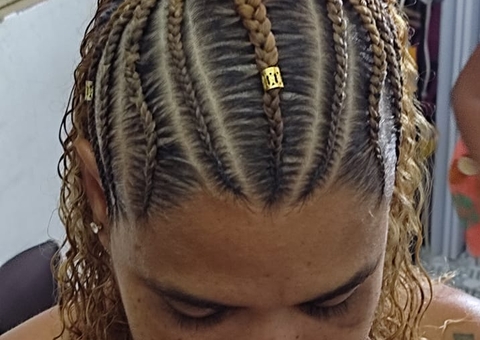 Anvisa proíbe venda de pomada para cabelos que causou cegueira em mulher