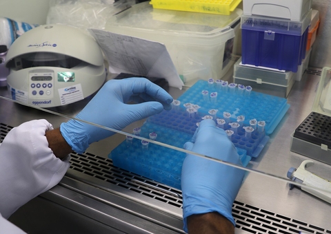 Amazonas não registra mortes por Covid-19 pela 3ª vez em menos de 2 meses