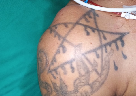 Hospital procura família de homem internado após ser espancado em Manaus