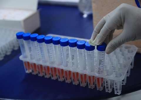 FVS-AM realiza testagem em professores e servidores de escolas particulares