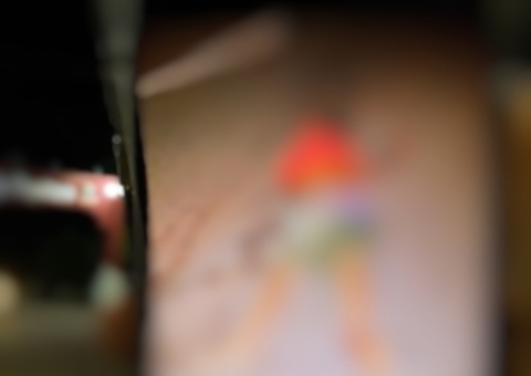 Idoso tem perna dilacerada e morre ao ser atropelado por carro na AM-010