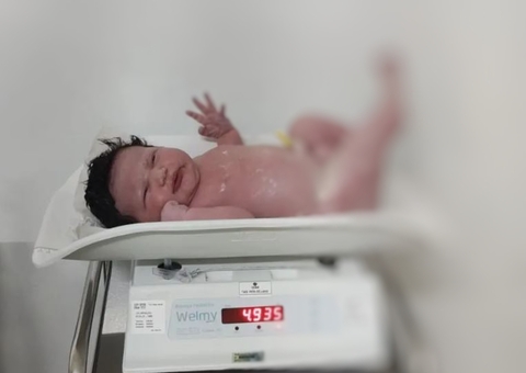 "Superbebê" de quase 5 Kg impressiona médicos e viraliza na web