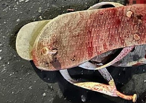 Adolescente vai parar no hospital ao ter cabeça crivada de tiros em Manaus 