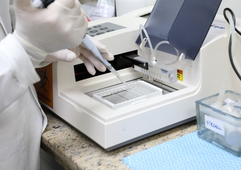 Lacen aumenta rede de laboratórios de tuberculose em municípios do Amazonas