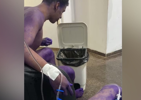 Trote universitário com produto tóxico deixa 4 calouros hospitalizados