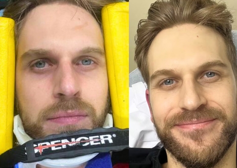 Humorista francês Paul Cabannes manda mensagem para filha após grave acidente