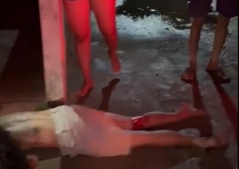 Motociclista fratura as duas pernas ao colidir com fiação durante furto em Itacoatiara