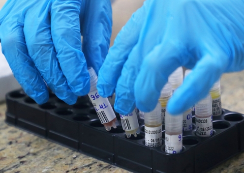 Amazonas registra 3 novos casos de Mpox 