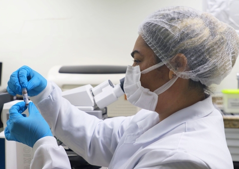 Amazonas registra 27 casos confirmados de Mpox, aponta boletim da FVS