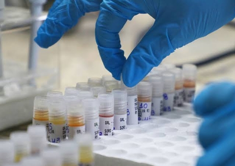 Casos confirmados de Mpox no Amazonas chegam a 44