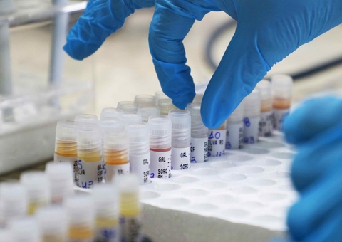 FVS divulga dados sobre a Mpox no Amazonas e reforça medidas de prevenção