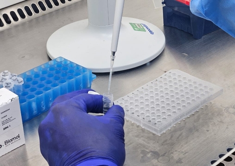 SRAG: Amazonas acumula 31 óbitos e 529 casos de vírus respiratórios em 2025