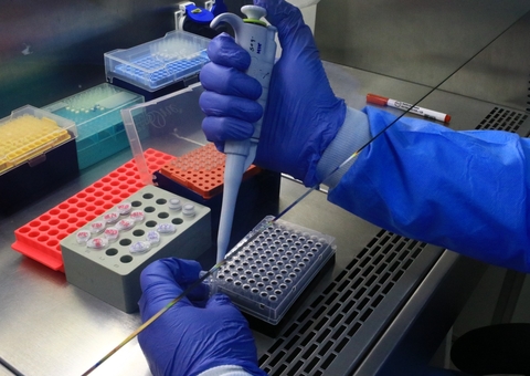 Amazonas tem 18 casos confirmados de Mpox