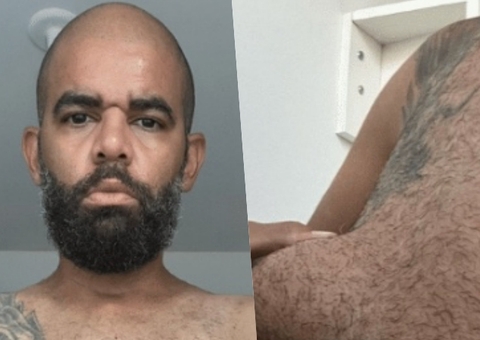 ‘Queria um corpo de academia rápido’, diz homem que ficou deformado após injetar gel em casa