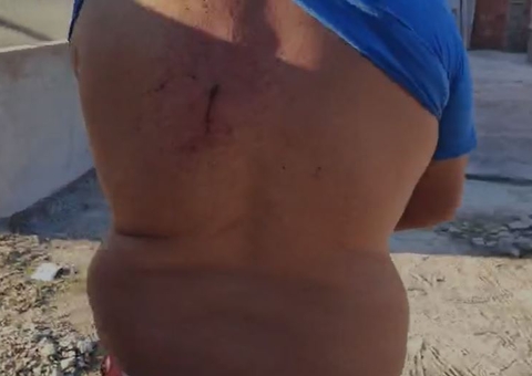 Criminosos invadem casa e atiram em vítima durante roubo na Cidade de Deus