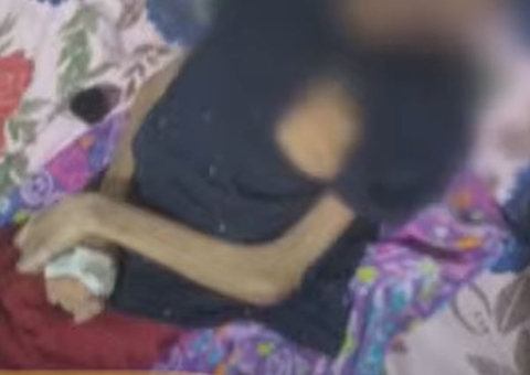 Adolescente deficiente que era vítima de maus-tratos em Manaus está na UTI