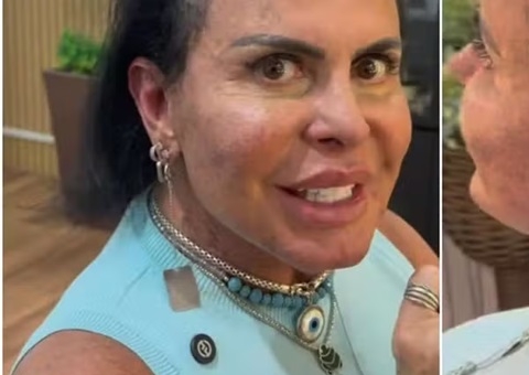 Gretchen impressiona ao mostrar cabelo real antes de trocar de aplique