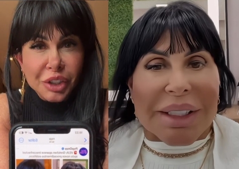 Vídeo: Gretchen se irrita com piadas sobre nova harmonização facial: 'não fiz'