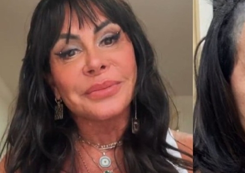 Gretchen surge calva e mostra manutenção nos fios: 'não cresceu mais'