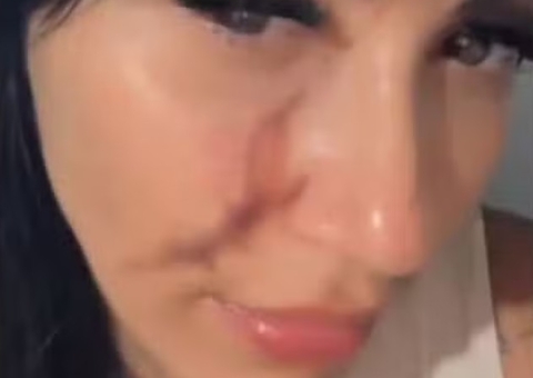 Briga por Roblox termina em tragédia em SP: 'Cara rasgada e sangue 