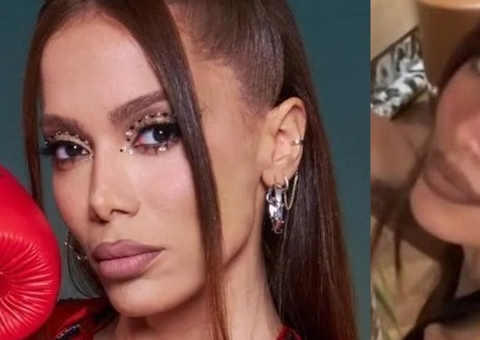 Anitta ressurge com 'novo rosto' em fotos e fãs reagem: 'a faca tava amoladíssima'
