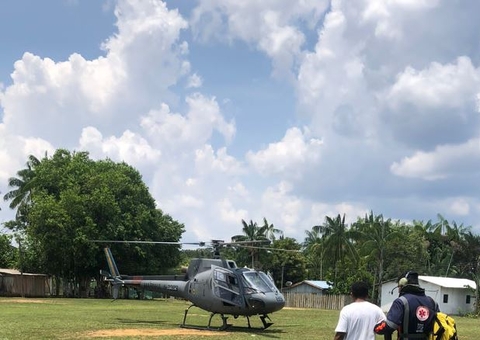 Criança picada por cobra é resgatada no Amazonas