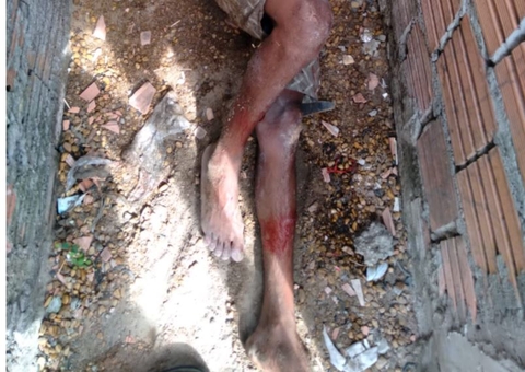 Homem é atacado a terçadadas e deixado para morrer em beco de Manaus