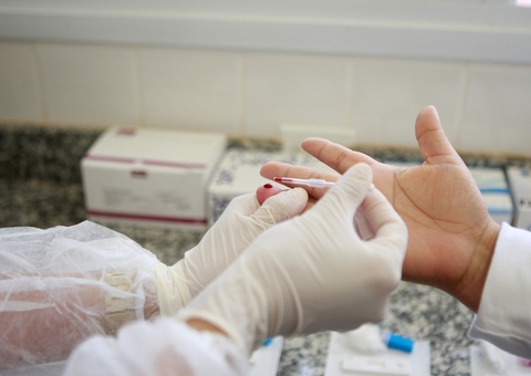 Ministério da Saúde inclui pessoas com HIV em grupo prioritário da vacina