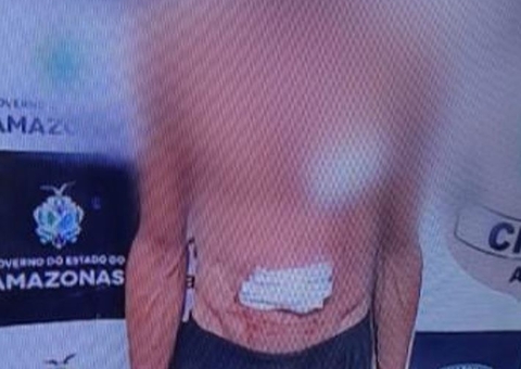 Homem esfaqueia esposa e crianças e ateia fogo em casa com família dentro no Amazonas