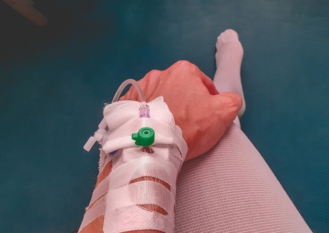 Câmara aprova PL que obriga cobertura de tratamento de câncer em casa