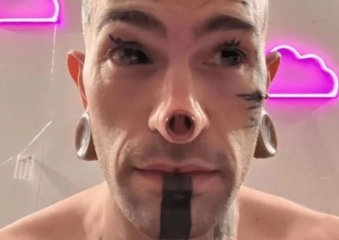 Homem surpreende ao arrancar ponta do nariz e deixar cartilagem à mostra