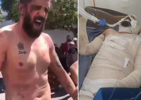 Jogador ateia fogo no próprio corpo após ser acusado de terrorismo