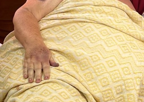 Idosa morre após ser espancada com bengala pelo próprio neto