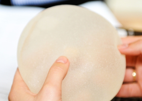 Anvisa proíbe próteses mamárias e glúteas após inspeção em linha de produção