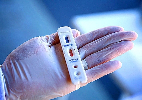 PL estabelece distribuição de autoteste de covid a beneficiários do Auxílio Brasil