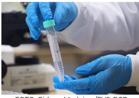 Sobe para 21 o número de casos confirmados de Mpox no Amazonas