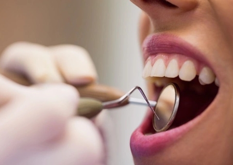 Saiba o que é halitose e quais as possíveis causas