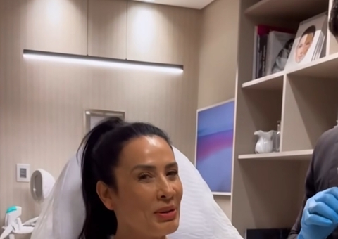 Scheila Carvalho remove preenchimento do rosto em busca da beleza natural 