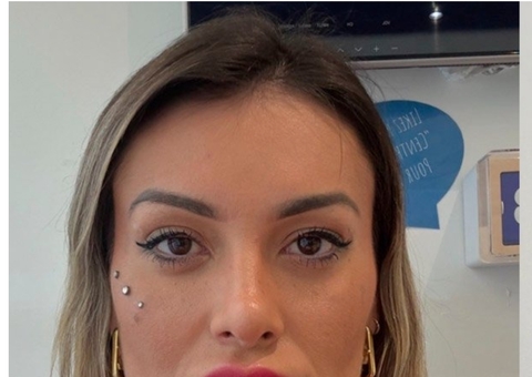 Andressa Urach passa por cirurgia para mudar a cor dos olhos 