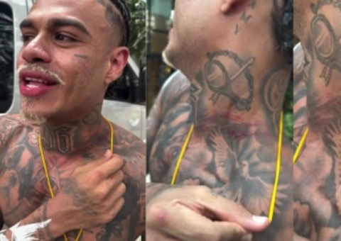 MC Cabelinho mostra ferimentos e relata tentativa de assalto no Pelourinho