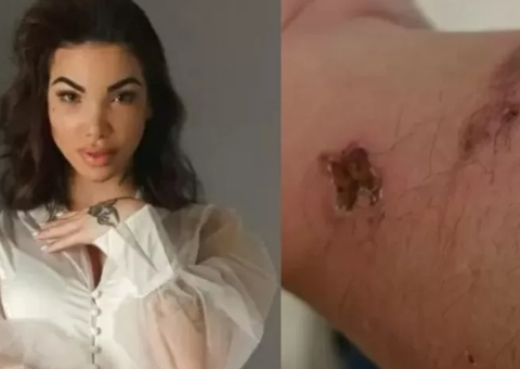 Torturado por influencer conta detalhes do crime: 'facadas na sola do pé' 