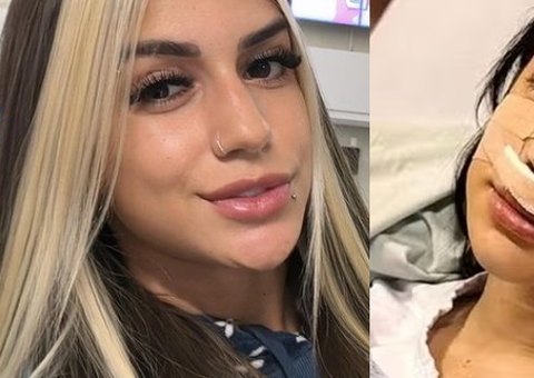 Influencer tira cartilagem da costela para rinoplastia e reclama de dores