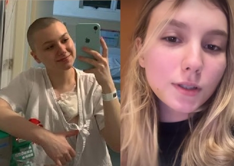 Isabel Veloso conta que vai voltar a ficar careca após novo transplante