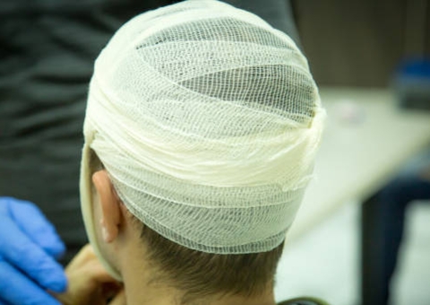 Jovem sofre traumatismo craniano após ser atingido por madeirada no Amazonas