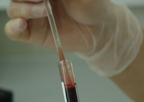 Genética: Garota de 13 anos é curada de câncer com células modificadas